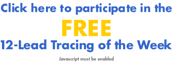 Click here for the Tracing
of the Week Quiz