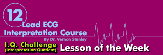 12 Lead ECG Interpretation Course
By Dr. Vernon Stanley
Try It! Lesson of the Week